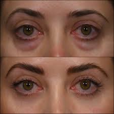 Image result for Blepharis transvaalensis