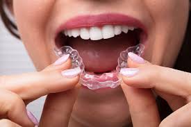 To use the crystals to clean your invisalign aligner trays, fill the container provided with warm water and stir in one packet of cleaning crystals to dissolve them and form a cleaning solution. Invisalign Clinica Dental Ortigosa