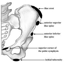 Image result for Pubic Apophysitis