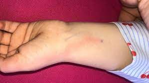 Si saint antoine est devenu patron des charcutiers et des brossiers, on le comprend aisément, en rapport avec le cochon, pour la production de cochonnailles, et ses soies pour la fabrication des brosses, et pinceaux. Une Publication Facebook Sauve La Vie De La Petite Norah 4 Ans Edition Digitale De Liege