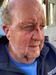 Man, 70, and pet dog are nearly trampled to death by herd of cows as farmer  handed fine