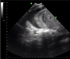 Image result for FAST Exam