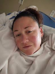 Do they do MR and lipo with a panniculectomy?