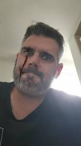 Matthew Coconis's Instagram, Twitter & Facebook