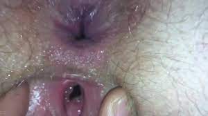 Hymen, anal pain for virgin girl - ThisVid.com