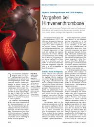Atypische Gerinnungsstorungen Nach Covid 19 Impfung Vorgehen Bei Hirnvenenthrombose