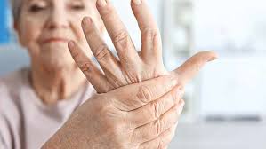 Neden Ellerde Uyusma Olur Guncel Yasam Haberleri