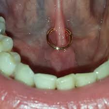 Tongue Piercing Guide 7 Types Explained 50 Photos Pain