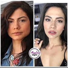 İşte demet özdemir'in yıllar önceki estetiksiz hali. Demet Ozdemir