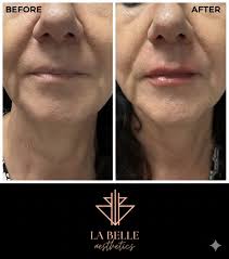 Dr Hayley Dutton (@labelle_aesthetic) • Instagram photos and videos