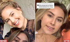 Über 7 millionen englische bücher. Woman Reveals Tmj Injections Totally Botched Her Smile Daily Mail Online