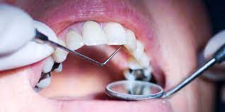 We did not find results for: How Can You Get Rid Of Cavities And Is That Even Possible