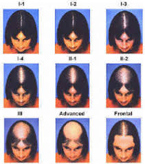 Seeing noticeable patches of thinner or missing hair, including a part on the top of your head that gets wider. Early Signs Of Hair Loss In Men And Women