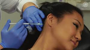 I got Botox for my sweat glands and never looked back 💦