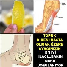Bilgi Panosundaki Pin