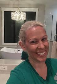 Woo y'all were right about the red face after the FHF chem peel 😂