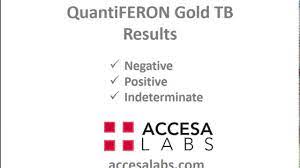 Quantiferon gold test locations near me. Quantiferon Gold Tb Test Near You Tb Blood Test Accesa Labs