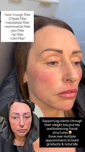 What an incredible glow up! She likes to call me her “magic lady” 🥰✨