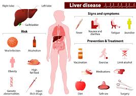 Liver disorder and enlarged liver in children is yet another factor that causes liver enzymes to accumulate in the blood. Liver Disease Symptoms Causes Treatment Narayana Health