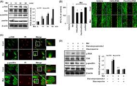 Menyediakan pautan ke laman web jabatan akauntan negara malaysia bagi memudahkan pengguna menyemak syarat syarat bagi wang tidak dituntut. Melatonin Enhances The Human Mesenchymal Stem Cells Motility Via Melatonin Receptor 2 Coupling With Gaq In Skin Wound Healing Lee 2014 Journal Of Pineal Research Wiley Online Library