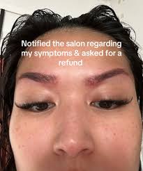 How to Know If Youre Allergic to Eyebrow Tint