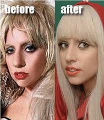 Gewöhnlich versteckt sich lady gaga hinter greller schminke, perücken und verrückten kostümen. Sneaky And Not So Sneaky Plastic Surgery 22 Photos Lady Gaga Plastic Surgery Lady Gaga Nose Plastic Surgery
