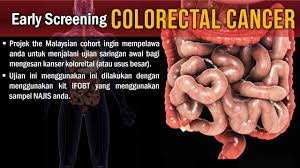 Oleh itu, individu yang berusia 50 tahun ke atas dinasihatkan untuk menjalani ujian saringan kanser kolorektal. Colorectal Cancer Screening The Malaysian Cohort