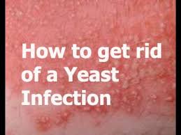 Both coconut oil and tea tree oil kill fungi, including yeast. Yeast Infection In Men How To Get Rid Of A Yeast Infection Youtube