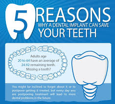 May 25, 2017 · how long does tooth extraction swelling last? How Long For Tooth Extraction To Heal Arxiusarquitectura