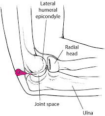 Image result for Elbow Joint Injection