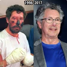 Hugh designs bionic prosthetics for natural human motion