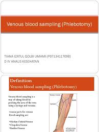 Image result for Venous Blood Sampling