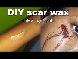 diy scar wax without vaseline and