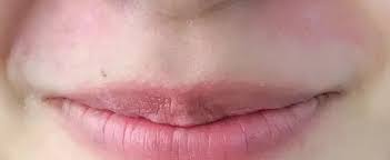 waxing upper lip