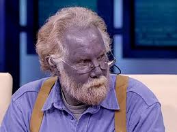 dr oz investigates the man who turned blue