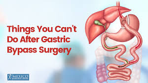 things you can t do after gastric