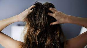 itchy scalp and hair loss link causes
