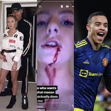 Police Arrest Manchester United Star Player Mason Greenwood, 20, While His  Club Suspends Him After His Girlfriend Shared Photos Alleging He Raped And  Physically Assaulted Her - TmZ Blog