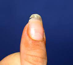 how to repair a nail split down the middle