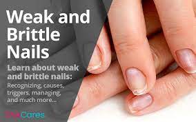 dry nails type of nail problems