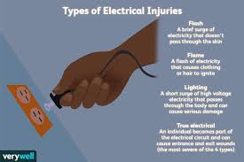 what to know about electrical burns