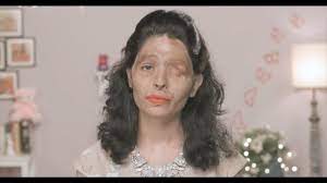 acid burn survivor creates makeup
