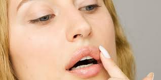 dry skin around the mouth