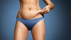 belly liposuction health beauty travel