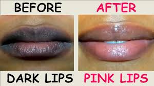 dark lips to pink lips challenge