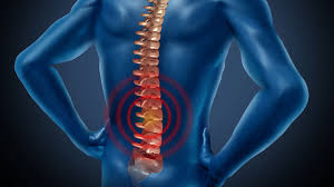 Дори и малък дискомфорт в гърба може в крайна сметка да се превърне в сериозен проблем. Bolki V Krsta Archives American Spinal Clinic