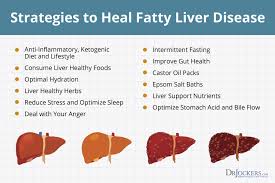12 Strategies To Heal Fatty Liver Naturally Drjockers Com