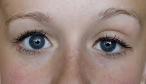 amblyopia lasik denver cataract surgery