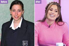 Stacey solomon has revealed that her natural teeth under her veneers are 'black and yellow' and it is her greatest fear for them to fall out . Stacey Solomon Shares Throwback To Before Pregnancy Destroyed Her Teeth And She Was Forced To Get Veneers