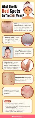 red spots on skin and prevention tips